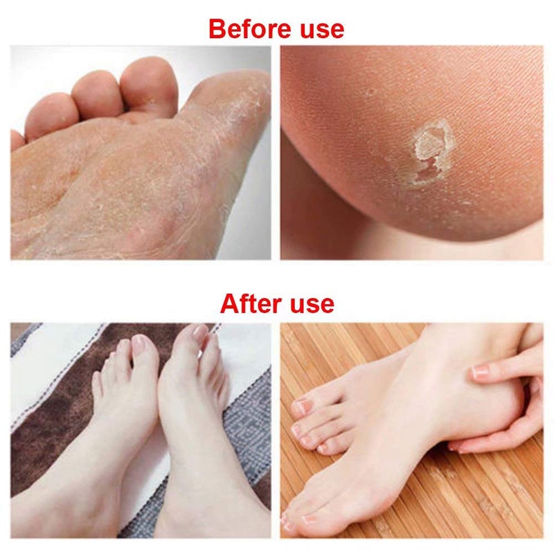 Paddsun 6Pcs Foot File Callus Remover Replacement Blades Pedicure Rasp Detachable Foot Scrubber Hard Skin Remove Stainless Steel Big Hole for Wet and Dry Feet - Image 3